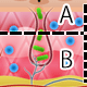 A.表皮/B.真皮
